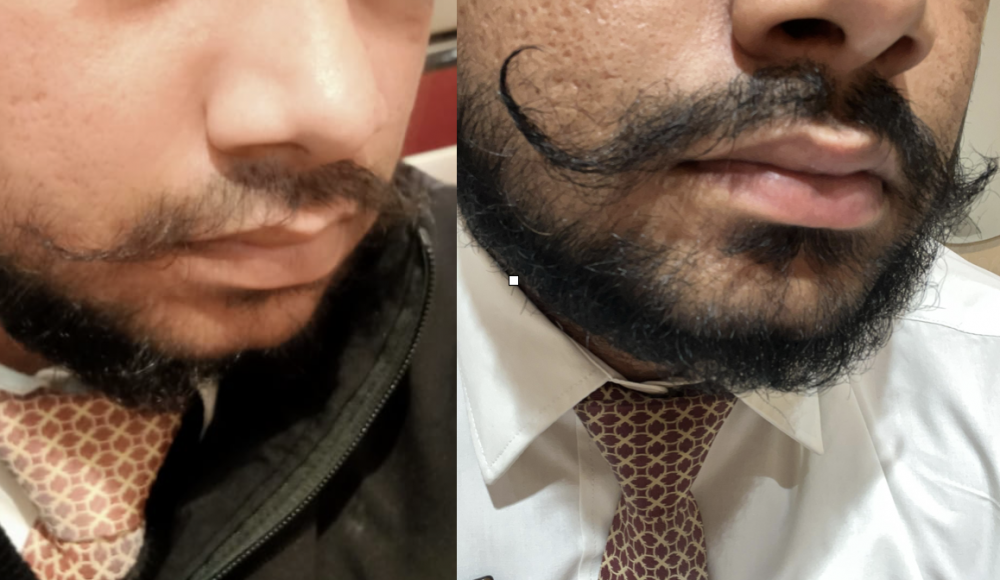 Second image of Hair Growth Oil